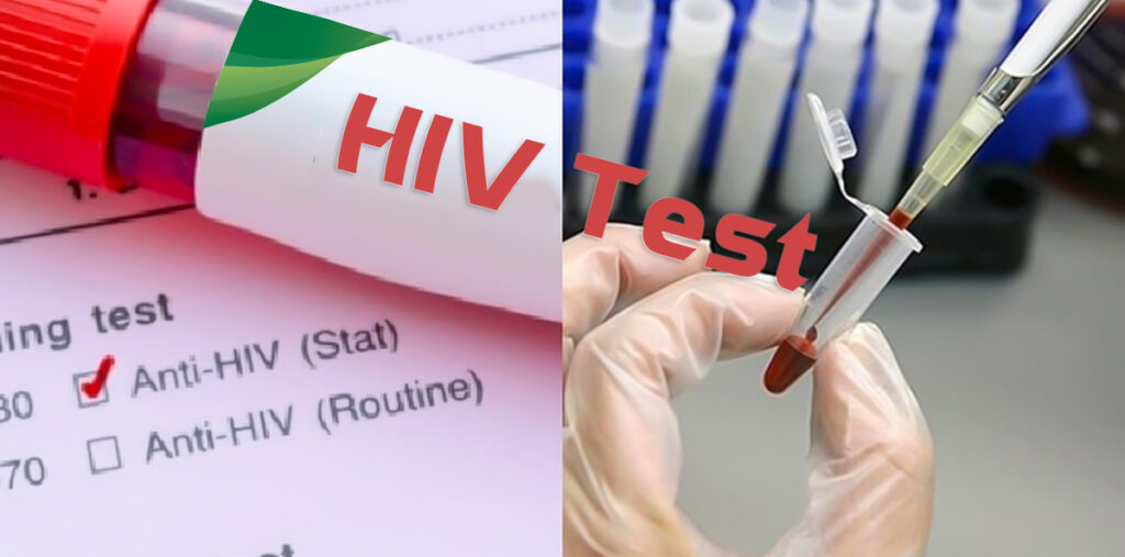 test nhanh hiv