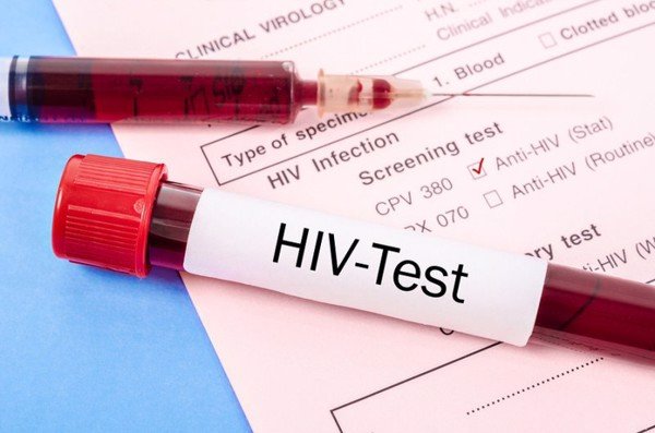 xét nghiệm hiv tại nhà