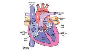  hẹp van động mạch phổi 